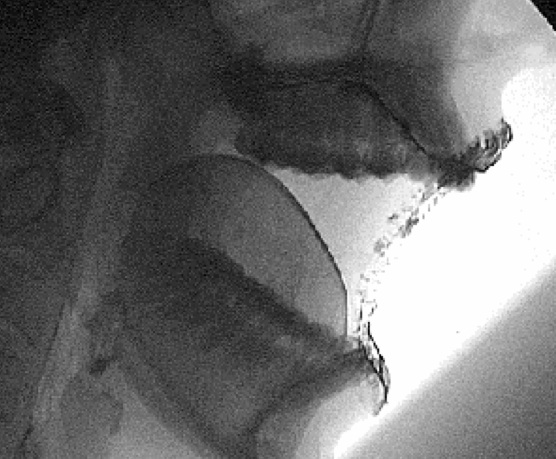 X-Ray-Mouth