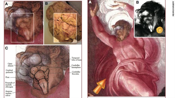 Brain stem hidden in Sistine