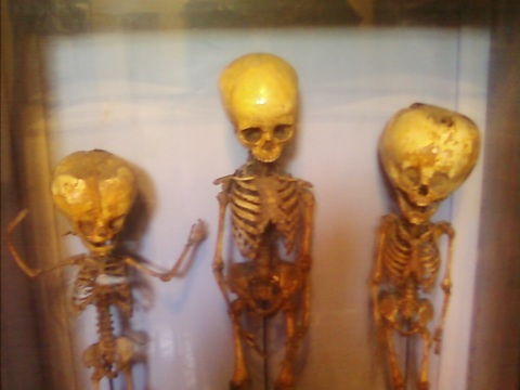 Jaunty Trio Of Malformed Doll Skeletons