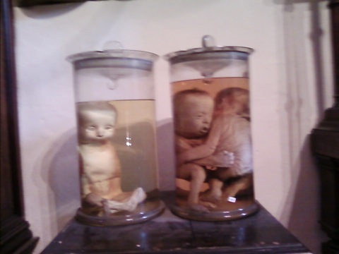 Pair Of Pickled Foetuses